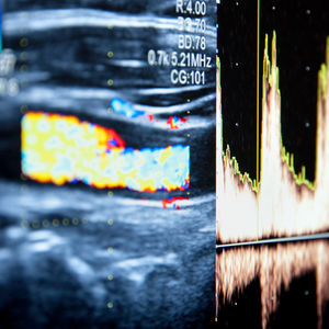 Sonographie: Ultraschall in der Gastroenterologie Ingolstadt